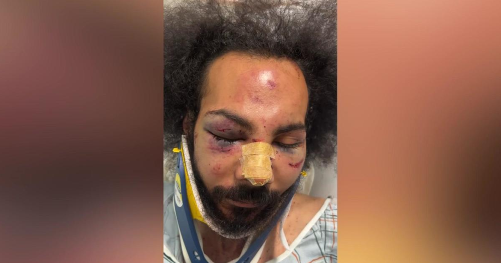 Jarrett Adorno, 25, was beaten with his own baseball bat.